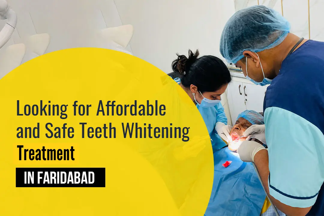 Teeth Whitening Treatment in Faridabad
