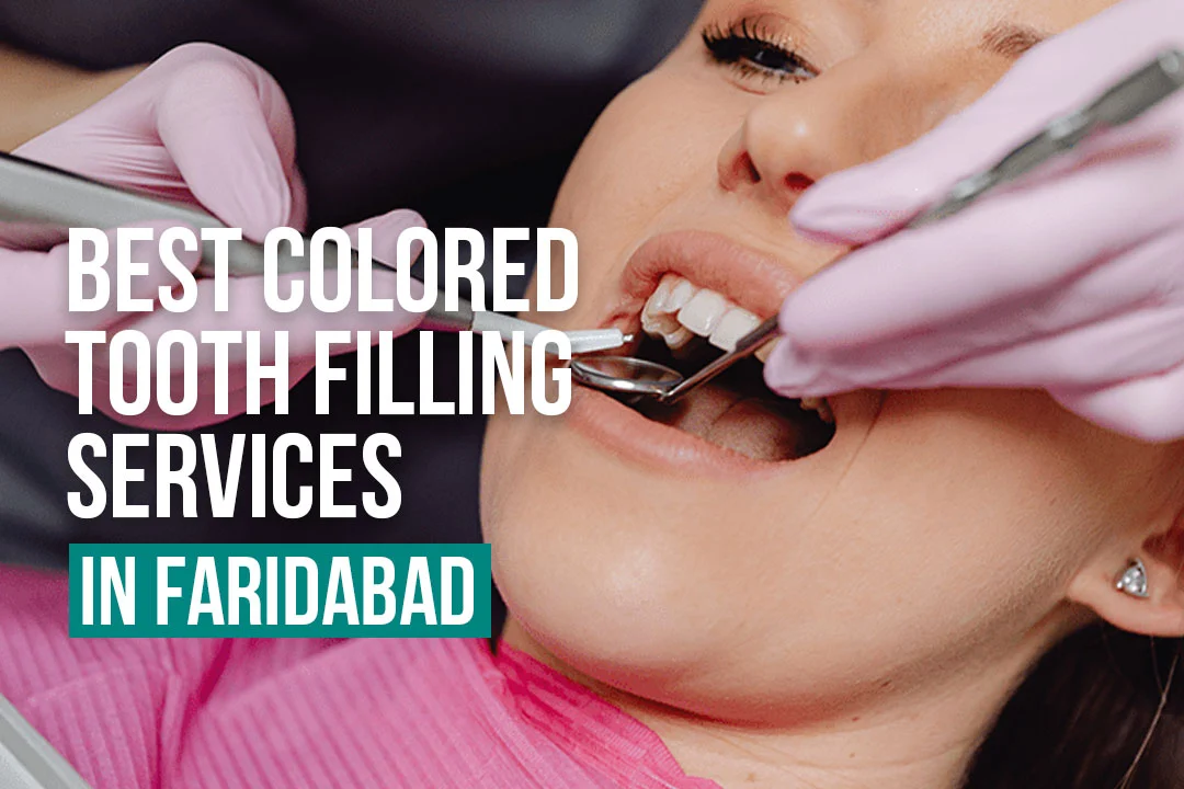 Best Colored Tooth Filling Services in Faridabad