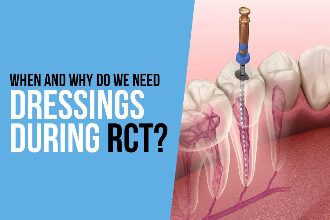 When and Why Do We Need Dressings During RCT