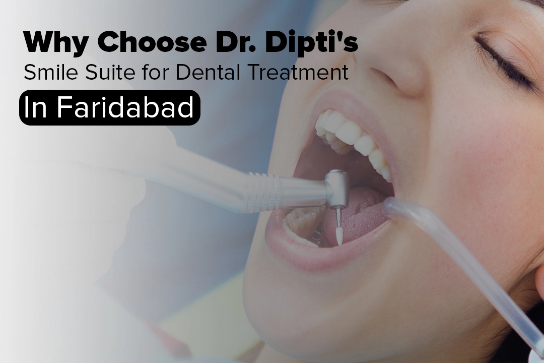 Dental Treatment in Faridabad