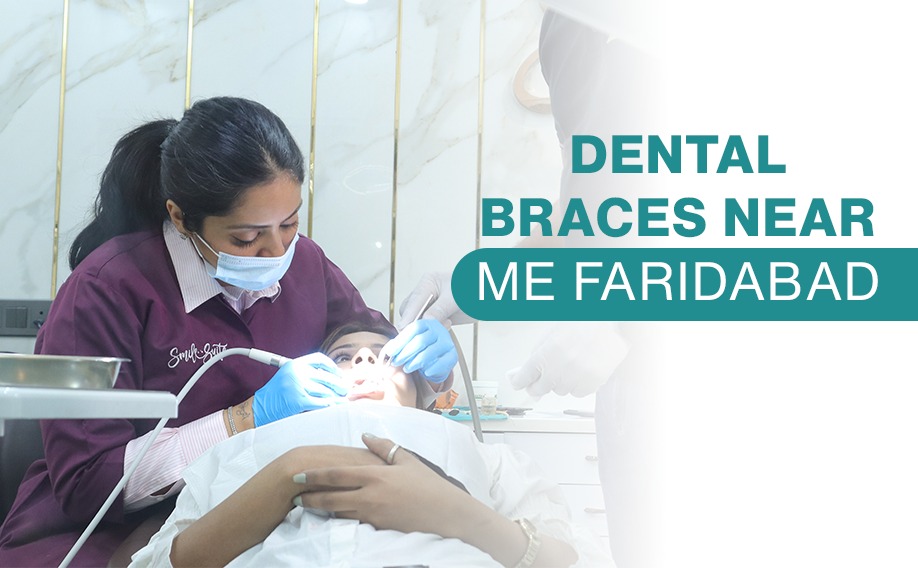 Dental braces near me faridabad