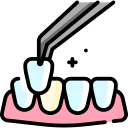 Dr. Dipti's Smile Suite | Dental Veneer
