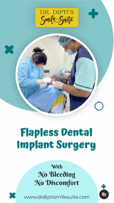 Flapless implant surgery